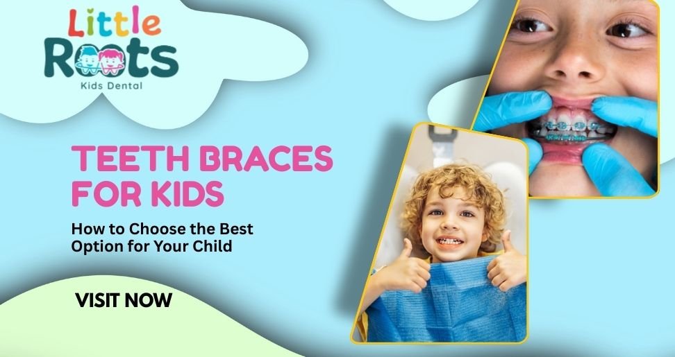 Teeth Braces for Kids: How to Choose the Best Option for Your Child | Little Roots