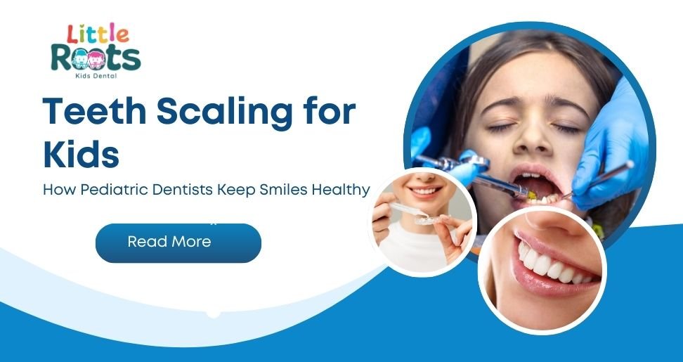 Teeth Scaling for Kids